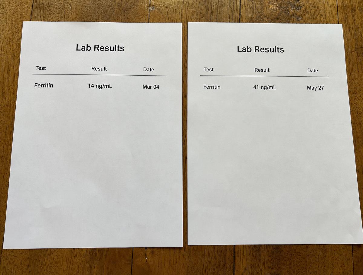 Illustrative photo of two generic lab result printouts side by side showing a ferritin value rising between two dates